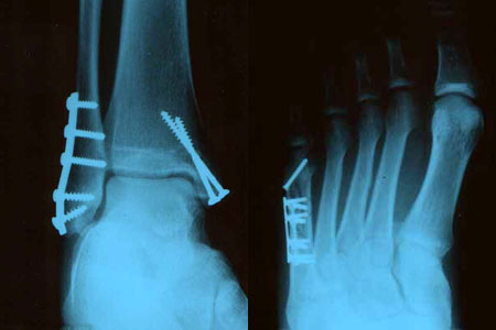 Grand Prix de France MotoGP 2006 : la présentation sur Moto-Net